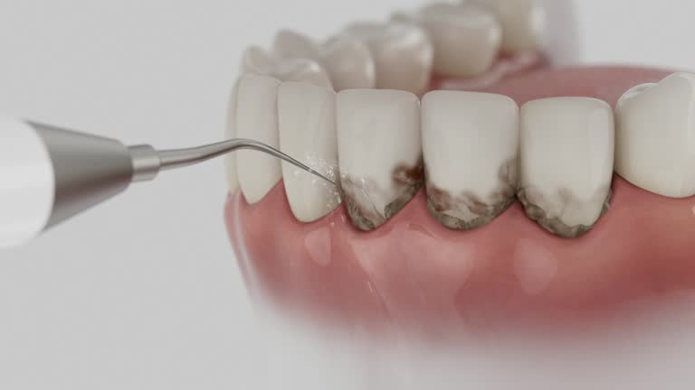 Reliable Dental Implants contractor in Groesbeck, OH by Smile Center Dentistry